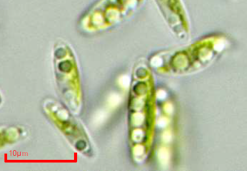 右:微細藻類コッコミクサKJ