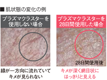 肌状態の変化の例